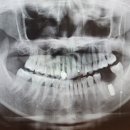 원더플란트치과의원 이미지