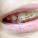 슈어치과교정과치과병원 | 영종도 어린이 치아교정 슈어치과교정과 치과병원