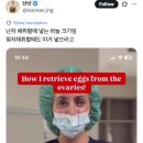 난자 채취할 때 넣는 바늘 크기 이미지