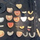 YJ치과기공소 이미지