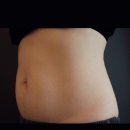 청담마이의원 이미지