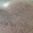 My hair