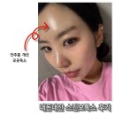 비올라셀성형외과의원 | 비올라셀성형외과 내돈내산 신사역 스킨보톡스 일주일차 후기