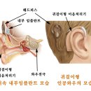 Re:인공와우 이해를 위한 글. 이미지