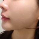 오광케어 이미지