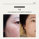 스킨케어, 편백효소찜질, 세신까지 한 번에 즐길 수 있는 광양 피부관리 마사지 샵 다온 방문 후기
