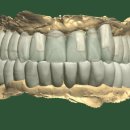 뉴치과기공소 이미지