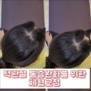 토월한의원 | 신월동피티 턱관절 통증완화를 위한 체형교정