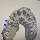 디자인치과기공소(DESIGN) | (주)거목 치과기공소의 초정밀 디지털 워크플로우를 완성하는 첨단 장비 시스템