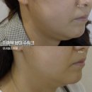 연세셀즈의원 이미지