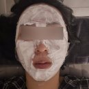잇츠멍 | [평택 피부과]잇츠미의원 평택 고덕점 스킨 보톡스 후기