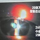 구산동 안과 ; 구산동 근처 굿아이안과, 백내장 수술로 맑은 세상 되찾은 후기!