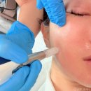 광진말1로 | 광진구 피부관리 서울 슈퍼젝션 전문센터 러브라이크 물광 후기