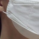 얼굴 접촉성 피부염 가려움 따가움 극복기 비판텐 연고 + 페로제 후기