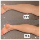 보니따피부관리 이미지
