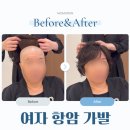 (주)센씨인모바일 | 여성항암가발 펌·염색 가능한 최신 제품의 특징