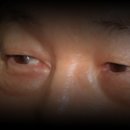 나솔채양로원 | 쉐어앤케어 캠페인 후기 : 안 보여도 별 수 있나... 그냥 사는거지