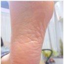 하이웨이마트 화도점 | 남양주 발각질 깔금하게 관리해주는 "탱스네일&amp;오로지푸스" 남편 발각질 관리 후기