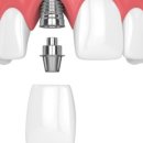 연세한치과의원 이미지