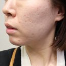 벤자롱스파삼성노블카운티점 | 영통 피부관리 - 벤자롱스파 삼성노블카운티점, 스파 리뷰
