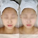 글리나에스테틱 | 광주 신안동 피부관리 '글리나에스테틱' 에서 얼굴 윤곽관리 후기(+주차정보)