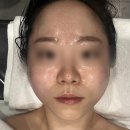 충청남도 천안시누리별장애인복지관 | [천안 성성동 에스테틱 추천]천안 윤곽관리 채움올림 천안점 : 성성동 에스테틱 웨딩관리 솔직 후기...