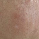 네오메딕스 이미지