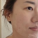 세리영 스킨케어 | 중랑구피부관리 문제성피부 관리잘하는 곳, 세리영스킨케어 후기