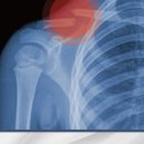 우정정형외과의원 이미지