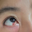 서울베스트안과의원 이미지