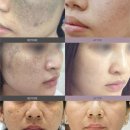 강화도 루비 이미지