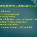 유방 섬유선종 Breast fibroadenoma 이미지