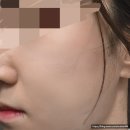 디에스비와이 | 압구정 에스테틱 비알 에스테틱 림핏 관리 솔직후기