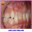 세종치과의원 | 세종특별자치시 반곡동 인근 치과 이도치과의원 후기 한번 살펴볼까요?
