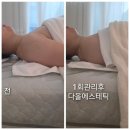 미끄럼틀테라피 | 대전 도룡동 에스테틱 알포유 테라피 다올에스테틱 후기