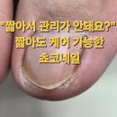 행신건강생활 | 원흥 행신 내성발톱 짧아도 관리 가능! 러닝 후 찾아온 내성발톱 관리 후기