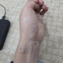 김천열쇠 | 목, 어깨, 허리 통증으로 방문한 김천 약손의 달인 솔직 후기