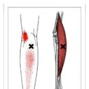 Brachioradialis (상완요골근) 이미지