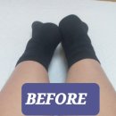 카이로센터 | 공덕역 자세교정 추천! 마포체형교정 웰카이로모션 비대칭 교정 후기