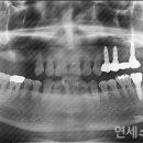 연세간석치과의원 네이버블로그