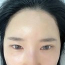 범계헤어라인왁싱 받고 이마라인 정리 성공! 다다뷰티엔왁싱 방문 후기