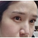 눈, 여기다 이미지