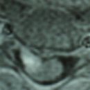 대구 등 통증, 흉추 디스크 때문인가요? [서부통신경외과] 대명동, 송현동, 서부정류장역, 야간진료, 월배