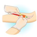 간 기능 검사[liver function test] 이미지