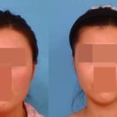 제이제이 이재화성형외과