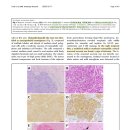 meningioma와 관련된 cerebral infarction이 관찰된 3마리의 개에 대한 case report 이미지