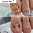 려원네일& 레푸스 네이버블로그