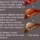 지방간에 좋은 음식 지방간 초기 증상 간수치 이미지