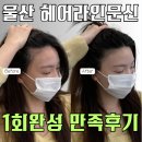 핏라인울산 | [M자탈모 고민] 울산 헤어라인 두피문신 * 2시간 완성 * 솔직 후기 (퀵앤핏헤어라인)
