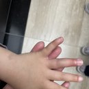 아산 탕정 연세바른 정형외과, 아이 손가락 골절로 다녀왔어요!